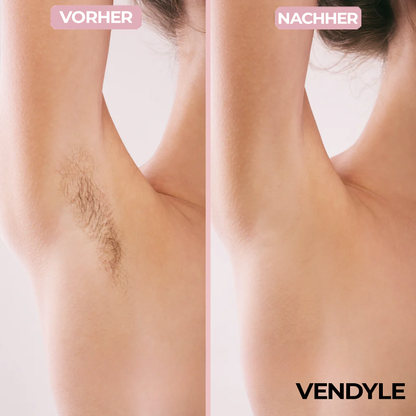 Vendyle™ 2-in-1 Damen Körperrasierer